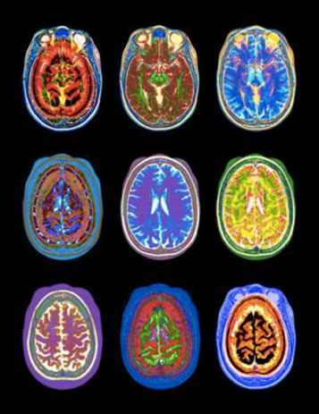 cerveau, neurosciences